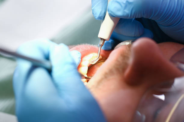 Best Urgent Tooth Repair  in Shoreview, MN