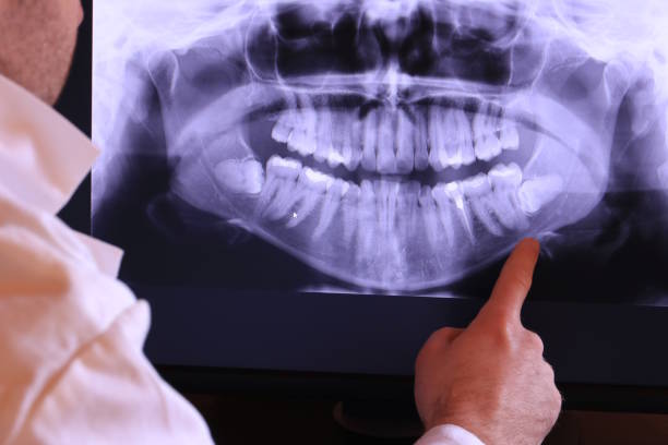Best Urgent Tooth Repair  in Shoreview, MN
